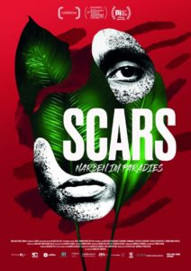 Scars